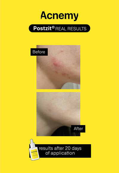 Postzit® before - after