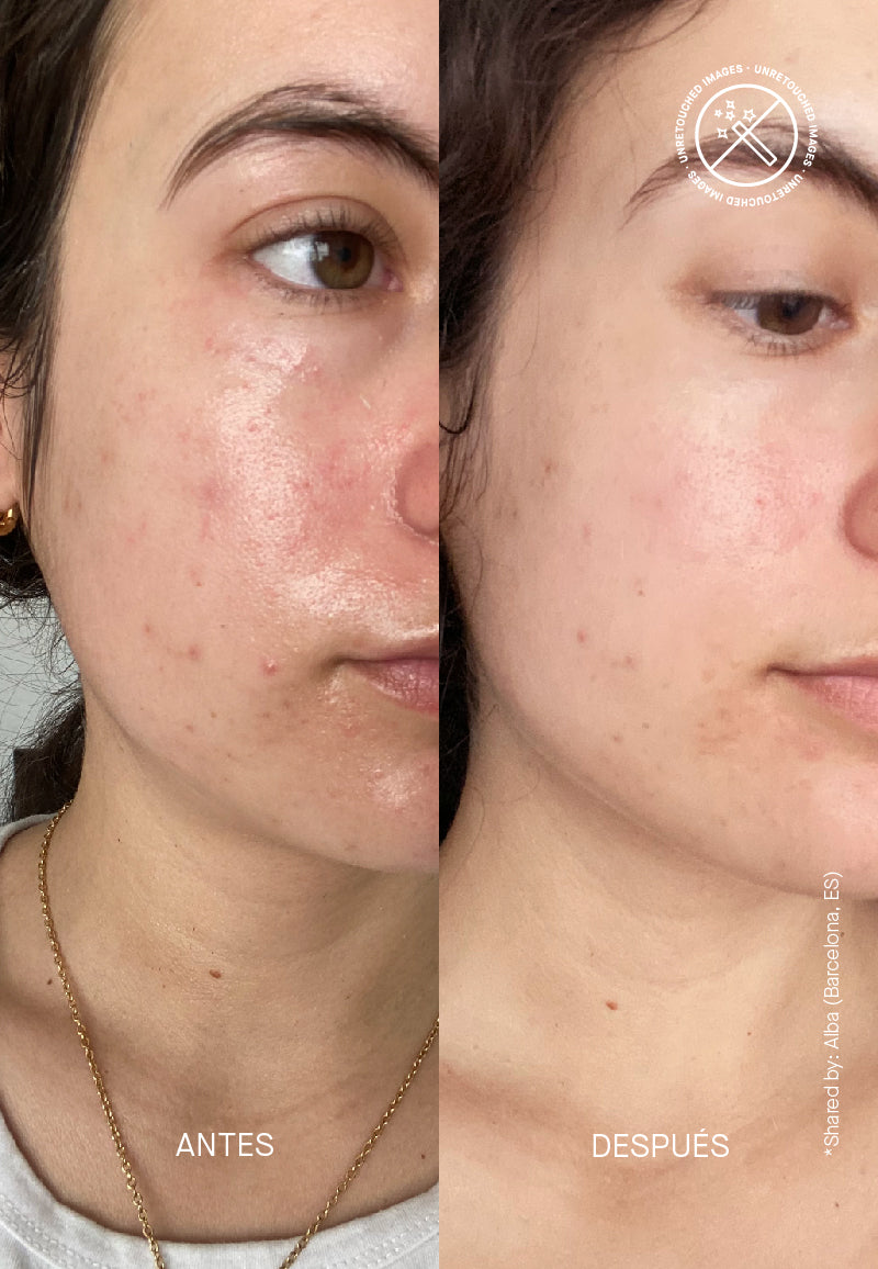 Barrier Restoring Hydrating Cream